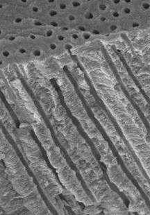 Kanaliki zębinowe średnica: od 3-5 µm przy granicy z miazgą do 1 µm przy zewnętrznej korona przy zewnętrznej