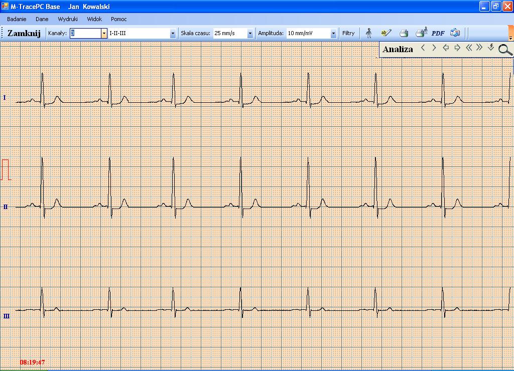 4.4.4. Zapis badania EKG Aplikacja M-Trace PC umożliwia zapisywanie badań w dwóch trybach: - tryb automatyczny - tryb manualny Aby rozpocząć zapis należy nacisnąć przycisk Start.