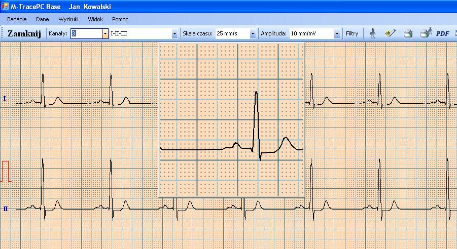 Jeśli całe badanie EKG nie mieści się na ekranie to za pomocą przycisków > oraz < użytkownik może przeglądać pozostałe fragmenty zapisu EKG.