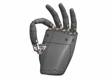 Plain bearings made of iglidur G and igubal KBRM rod end bearings ensure an efficient system in a bionic hand prosthesis and allow the dimensions of the hand to be reduced.
