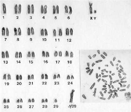 2n=45 (XX) (15;22); (13;14) translokacje Robertsonowskie normalny t.
