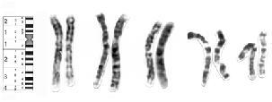 Chromosomy człowieka: schemat (idiogram/ideogram; obraz rzeczywisty