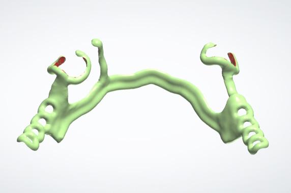 Ryc. 9. Gotowy, końcowy wirtualny projekt przyszłej części metalowej protezy szkieletowej, przeznaczony do druku 3D (fot. Techdent).