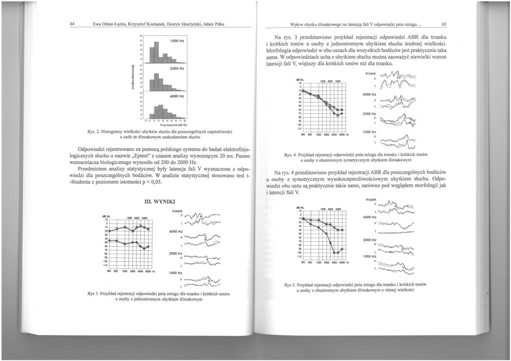 64 Ewa OrkanŁęcka, Krzysztof Kochanek, Henryk Skarży ń s ki, Adam Piłka Wpływ ubytku ś limakowego na!atencj ę fali V odpowiedzi pnia mózgu o 65 Pró g slyszenia [d B H...] Rys. 2.