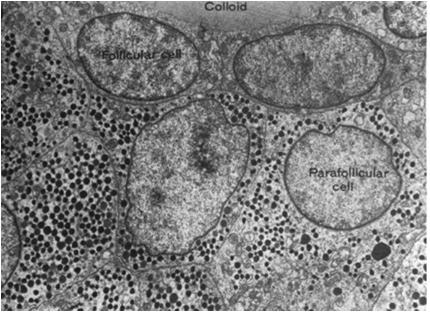 (tyreoglobulina i jodowana