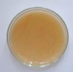 Rhodococcus erythropolis IN 71 Pseudomonas sp. Pseudomonas veronii G 123 Penicillium sp. Penicillium chrysogenum G-124 Phanerochaete sp.