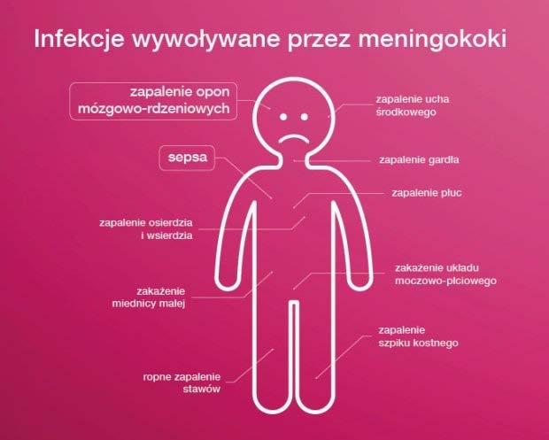 Diagnostyka Mikroskopia - płynu mózgowow-rdzeniowego, krwi, wybroczyn skórnych (te dwa ostanie mało czułe) Hodowla - podłoże Thayera-Martna (35-37C, 5% CO2) Biologia molekularna Leczenie - Penicylina