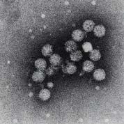 4. Orgnizmy modelowe Prokriot reprezentowne są przez Escherichi coli orz Mycoplsm pneumonie Wirus