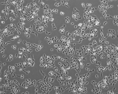 UNIWERSALNOŚĆ METODY aberration number/cell 1,8 1,6 1,4 1,2 1,0 0,8 0,6 0,4 0,2 0,0 60 Co γ rays 12 C ions 0 1 2 3 4 5 6 7 Dose (Gy) KOMÓRKI CHO-K1 (CHINESE HAMSTER OVARY CELLS) www.