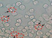 Jakość powietrza VIRUS Doctor poprawia jakość powietrza w pomieszczeniach, eliminując zanieczyszczenia biologiczne zagrażające zdrowiu: wirusy, bakterie, roztocza, pleśń i czynniki wywołujące alergie.