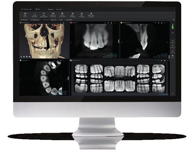 DTX Studio suite - platforma do kompleksowego prowadzenia leczenia Specyfikacja techniczna Pracując z KaVo OP 3D możesz korzystać z DTX Studio suite*, zintegrowanej platformy cyfrowej dla