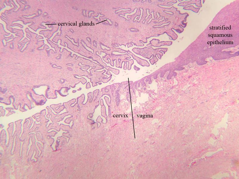 Szyjka macicy (cervix uteri) błona śluzowa nie złuszcza się podczas menstruacji nabłonek: walcowaty - komórki wydzielnicze (śluzowe) i komórki z migawkami stosunkowo duże, szeroko rozgałęzione
