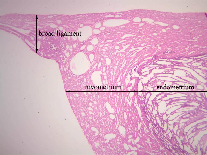 Macica (uterus) 1. Błona zewnętrzna (perimetrium) 2.