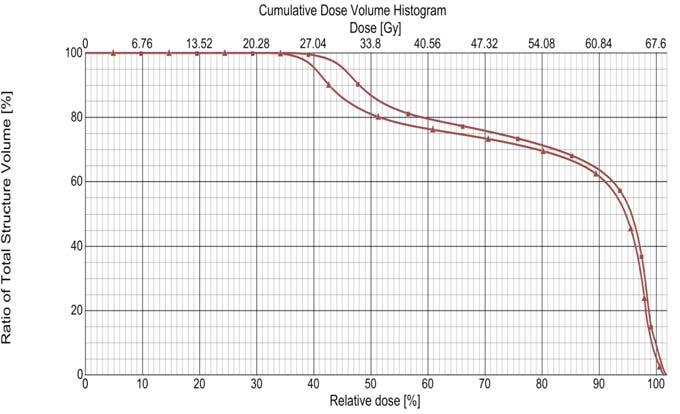 Analysis of the impact of changes in the angle of the Multileaf Collimator on dose in rectal in prostate cancer 45 DISCUSSION The rectum is a susceptible organ.