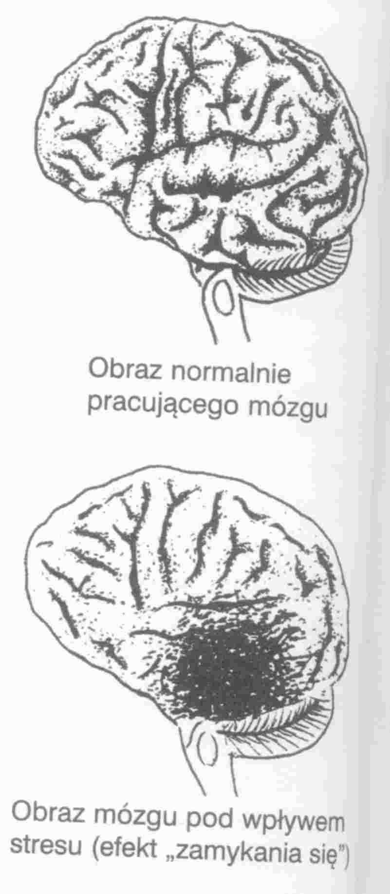 Stres zabiera 30 % energii potrzebnej do uczenia się.