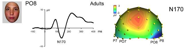 przypomnienie: N170 analog N1 widoczny przy