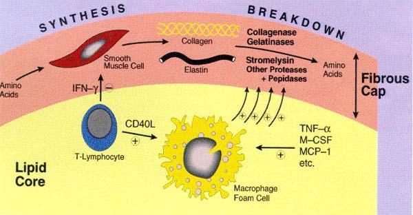 Rola komórek zapalnych i metaloproteinaz
