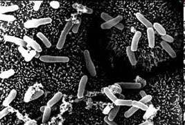 Clostridium perfringens -Do najczęstszych czynników predysponujących należą ciężkie urazy penetrujące lub zmiażdżenie tkanek