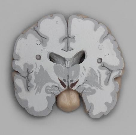Model mózgu, przekroje czołowe Nr ref: MA00740