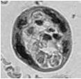 trofoblastu i nabłonka endometrium W łożyskach śródbłonkowokosmówkowych: