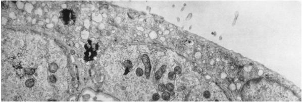 trofoblastu liczne organelle pęcherzyki (transcytoza) mikrokosmki