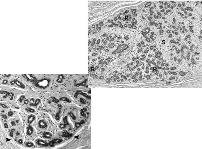 (fibroblasty) endometrium duże, okrągłe/owalne jasna kwasochłonna cytoplazma