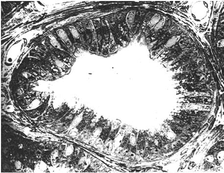 jądra nabłonek walcowaty komórki mioidne labirynt łączących się