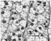 mitochondria z tubularnymi grzebieniami (końcowe