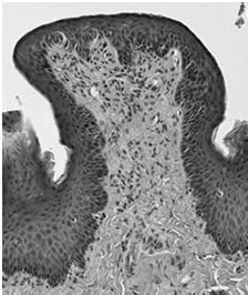 beczułkowata grupa walcowatych komórek nabłonkowych (50-100) wmontowana w otaczający nabłonek