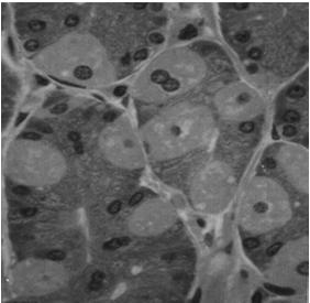 Komórki okładzinowe duże, piramidowe/owalne kwasochłonne niekiedy