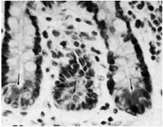 Komórki Panetha Komórki szczoteczkowe (rzadkie)