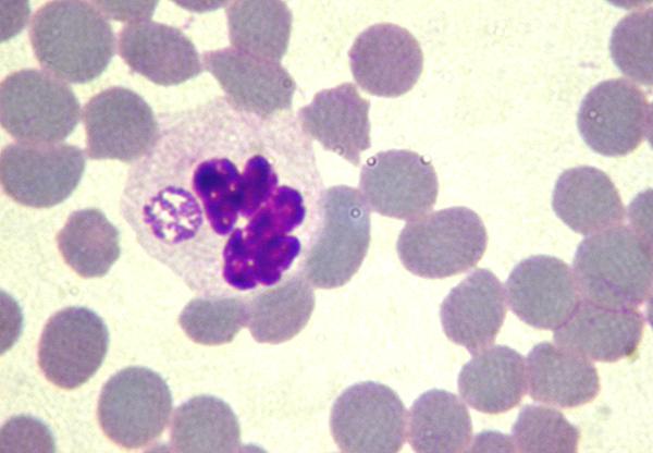 obserwacje własne 2 Fot. 1. Obecność moruli A. phagocytophilum w neutrofilach Objawy kliniczne anaplazmozy są nieswoiste.