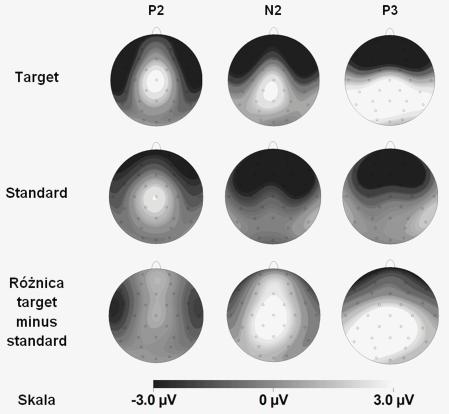 Elektrofi zjologiczne korelaty zaburzeń uwagowych u dzieci z ADHD... p<.001. Komponent P2 był zdecydowanie silniej wyrażony w sygnale zebranym z odprowadzenia Cz (3.09 ± 2.9 μv) oraz Pz (1.54 ± 2.