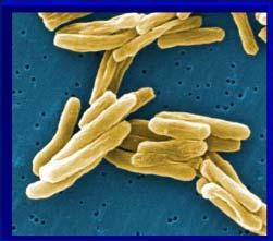 tuberculosis są trudno wykrywalne za pomocą barwienia Gram, gdyż duża ilość kwasów mykolowych (lipidy) uniemożliwia barwienie. 2. Geny Prokariota: M. tuberculosis M.