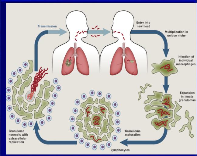 Po dostaniu się do płuc, bakterie infekują makrofagi, które wykorzystywane są do transportu do głębiej położonych tkanek. Powstaje swoisty agregat makrofagów: ziarniniak (ang.
