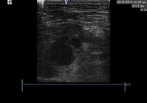 Ultrasonografia uciskowa minimum 4