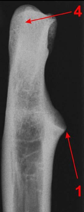 ununited anconeal process, UAP) oraz oddzielającą martwicę kostno-chrzęstną bloczka k. ramiennej, tzw. osteochondrozę (ang. osteochondritis dissecans, OCD).