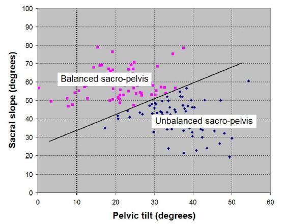Criteria of balanced and unbalanced pelvis PT SS Hresko MT, Labelle H, Roussouly P, Berthonnaud E.