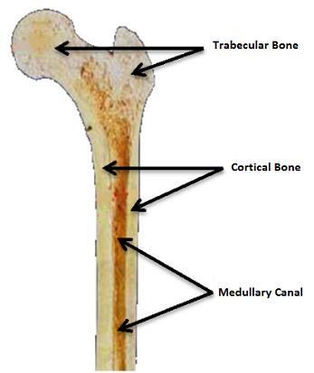 Wstęp Mniejsza średnica kanału trzonu kości udowej Zdjęcia RTG w projekcji ap i osiowej są