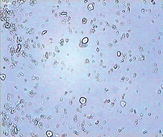 Rycina 3. Zdjęcia mikroskopowe sporządzonych zawiesin (znacznik skali 10 µm): A tabletki Atacand (rozcieranie, metoda I) w fazie Ora-Sweet SF (temp.