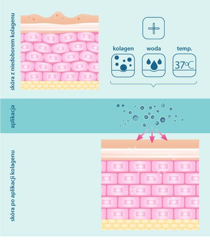Jak przenika i działa aktywny biologicznie, polski, rybi kolagen? Żel kolagenowy, bezpośrednio aplikowany na powierzchnię skóry, ulega despiralizacji pod wpływem temperatury naszego ciała ok. 37 C.