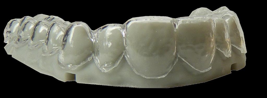 Modele w ortodoncji