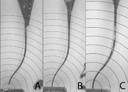 Mean value of resin removed from inner and outer wall of canal in S-canals in second curvature according to sequences of instruments odległość od wierzchołka Ryc. 6.