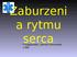 Zaburzeni a rytmu serca. Przygotowała: Joanna Gnarowska II RM