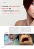 Leczenie naczyniowych schorzeń ust z zastosowaniem lasera