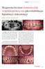 Skojarzone leczenie ortodontyczne i implantoprotetyczne jako rehabilitacja hipodoncji i mikrodoncji