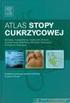 Cukrzyca, stopa cukrzycowa. <strong>autor:</strong> Jan Namysł 14 października 2013