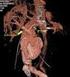 Aneurysm rupture into a large vein case reports