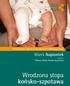 Wrodzona stopa końsko-szpotawa. Marek Napiontek. Przewodnik dla rodziców (i nie tylko) dzieci dotkniętych wadą.