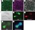 DATA ACQUISITION AND ANALYSIS FOR FLUORESCENCE TARGETED BIOPSY AKWIZYCJA I ANALIZA DANYCH DLA CELÓW BIOPSJI Z WYKORZYSTANIEM OBRAZÓW FOTODYNAMICZNYCH